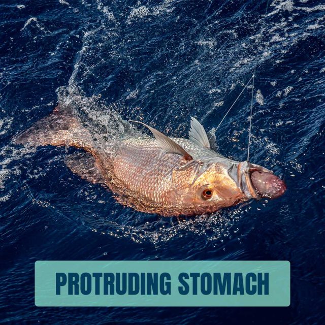 protruding-stomach